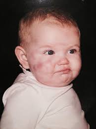 Girl with rare genetic condition feels no pain