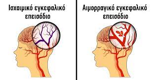 Οι δύο κύριοι τύποι εγκεφαλικών. 7 Symptwmata Egkefalikwn Epeisodiwn Stis Gynaikes Ti Les Twra