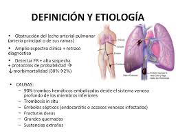 Ejemplo 3d del thromboembolism pulmonar trombosis del buque. 2018 06 07 Tromboembolia Pulmonar Ppt