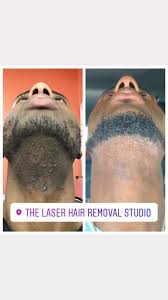 Sorted by recently answered 14 questions. The Laser Hair Removal Studio Home Facebook