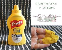 Maybe you would like to learn more about one of these? Kitchen First Aid Tip For Burns B4 And Afters Using Mustard First Aid Tips Burns Treatment Mustard For Burns