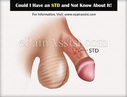But these photos show you what stis can look like. Could I Have An Std And Not Know About It What Are The Symptoms