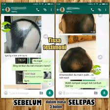 Bahkan ramai juga yang inginkan rambut lebat seperti artis bollywood. Jom Lebatkan Rambut Dengan Habbatussauda Nak Lebatkan Rambut Tapi Semua X Berkesan Jom Try Tissa Jaminan Wang Dikembalikan Kalau X Lebat Set Hair Tonic Shampoo Merawat