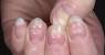Beau S Ridges