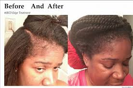 Use castor oil for hair to create a stunning hair transformation right when you need it. Jamaican Black Castor Oil In Natural Hair Kenya Facebook