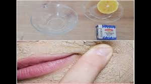 Koltuk altına diş macunu sürerseniz, bakın neler oluyor ! 5 Dakikada Dis Macunu Ile Kararmis Koltuk Alti Dirsek Ve Dizlerinizi Beyazlatin Cilt Beyazlatma Youtube