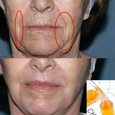 Lissette Espinal (mlissette77)