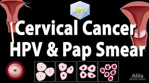 Cervical cancer is the fourth most common cancer found in women worldwide. Cervical Cancer Hpv And Pap Test Animation