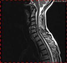 Maybe you would like to learn more about one of these? Entzundliche Veranderungen Rheumatoidarthritis
