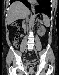 Our online radiology trivia quizzes can be adapted to suit your requirements for taking some of the top radiology quizzes. Abdomen Quiz Radiology Cafe