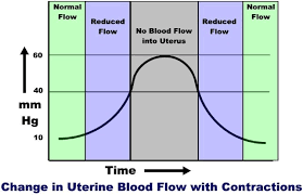 Monitoring Uterine Activity During Labor A Comparison Of