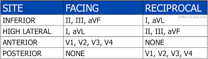 Contiguous And Reciprocal Lead Charts Ems 12 Lead