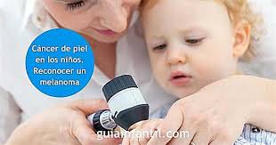 The sun's uv rays can damage your skin in as little as 15 minutes. 1wa8gradtu4ubm