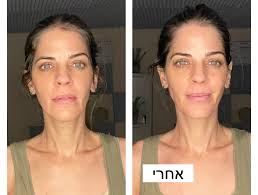 תושבים למען תושבים גדרה