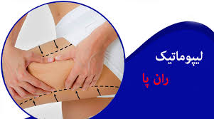 آیا لیپوماتیک بازو درد دارد+آیا لیپوماتیک ران درد دارد+بعد از اسلیو معده دوباره چاق می‌شویم+چرا بعد از عمل ابدومینوپلاستی باید گن پوشید