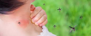 Image result for mosquito bite