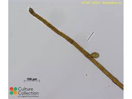 Image result for Sphaerella sp.