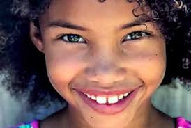 Myopia Management Treatment Methods