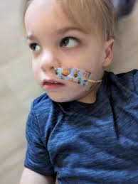 I won't know a plan until we see Dr. Merrill