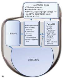 Check spelling or type a new query. Implantable Cardioverter Defibrillators Device Technology And Implantation Techniques Clinical Gate