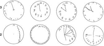 B, top, scatter plot of the of the relationship between moca and libon scores; Clock Drawing Test Springerlink