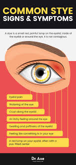 Black tea hot towel stye occasionally. How To Get Rid Of A Stye Get Collagen Supplements South Africa