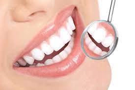 Already eligible for blue cross and blue shield retiree coverage through your employer? Veneers And Dental Bonding