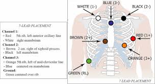 A nurse will clean the areas with alcohol and then place the electrodes on your chest. Holter Monitor Uses Instructions Preparations And Holter Monitor Results