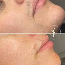 Swinley Laser Clinic