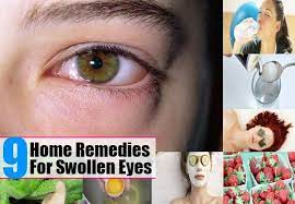 9 Top Home Remedies For Swollen Eyes Remedies For Swollen Eyes Swollen Eyes Skin Tags Home Remedies
