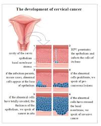 It is often assumed that pap smears can detect any cancer associated with the reproductive system. The Pap Smear Sexinfo Online