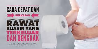 Saluran darah yang membengkak ini akan terkeluar semasa atau selepas anda membuang air besar dan seterusnya akan membentuk sebuah benjolan yang kecil dan lembut. Rawat Buasir Anda Dengan Cepat Dan Berkesan Elak Pembedahan