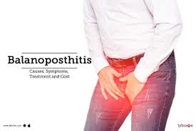 Image result for balanoposthitis