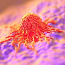 Only a small number of people with hpv will develop cervical cancer, but almost. Cervical Cancer Health24