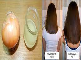 10 Hausmittel Fur Naturlich Volles Haar Zwiebelsaft Vorher Nachher Volleres Haar Frisur Dicke Haare Haarmittel