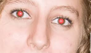 Red Eye Distortion Red Eyes Photo Eyes