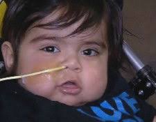 Birth Defect Forced Toddler to Receive 8 Organs in a Transplant