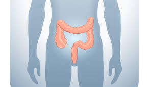 But they are basically similar. Aacr2021 Early Onset Colorectal Cancers From Patients Of Different Races May Exhibit Distinct Genetic Features Ecancer