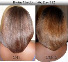 It acts as a coenzyme, and also referred to as coenzyme r. Hair Vitamins Savvy Hair Studio101 Hair Vitamins Biotin Hair Growth Natural Hair Growth