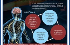 Yuki n., kokubun n., kuwabara s. Causas Sindrome De Guillain Barre Peru Sindrome De Guillain Barre