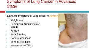 What is the first symptom of lung cancer. Early Symptoms Diagnosis And Detection Of Lung Cancer Dr Prof A