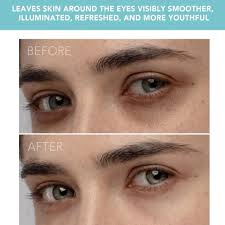 FOREO IRIS Illuminating Eye Massager Anti Aging Dark Circle & Eyebag  Remover NIB