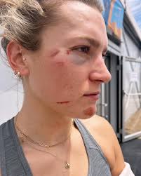 For those of you that are getting bored of the typical end year  highlights…my 2023 was a shiner 👀🖤😂