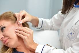 Servicio de Acupuntura en Écija