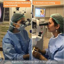gozyasi kanal tikanikligi ameliyatinda cilt kesisi olmasini tercih etmiyorsak multidiod lazer yontemini kullaniyoruz kanal gozler bilgi