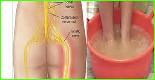 Powerful natural remedies for dementia and alzheimer's. 10 Home Remedies To Manage Sciatica Prevention Tips