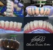 China Opal 1 Zirconia Dental Ceramic Powder PFZ Effect ...