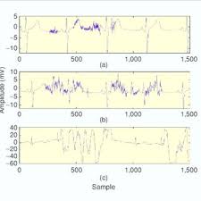 In this paper we proposed a technique to remove baseline wander using kaiser windowing filter and wavelet transform, among which wavelet is most powerful and effective tool for analyzing transient signal. Standard Ecg Features A Wandering Baseline B Motion Artifact And Download Scientific Diagram