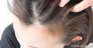 Wir gehen bei normalen haaren etwa von einer dicke von 0,12 grund dafür ist das anlagern von farbpigmenten am haarschaft. Dunne Haare Tipps Zur Schnellen Abhilfe Netdoktor