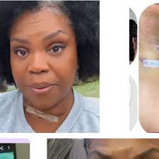 Fundraiser by Beloved Dillard : Beloved Dillard, medical bills, and housing!